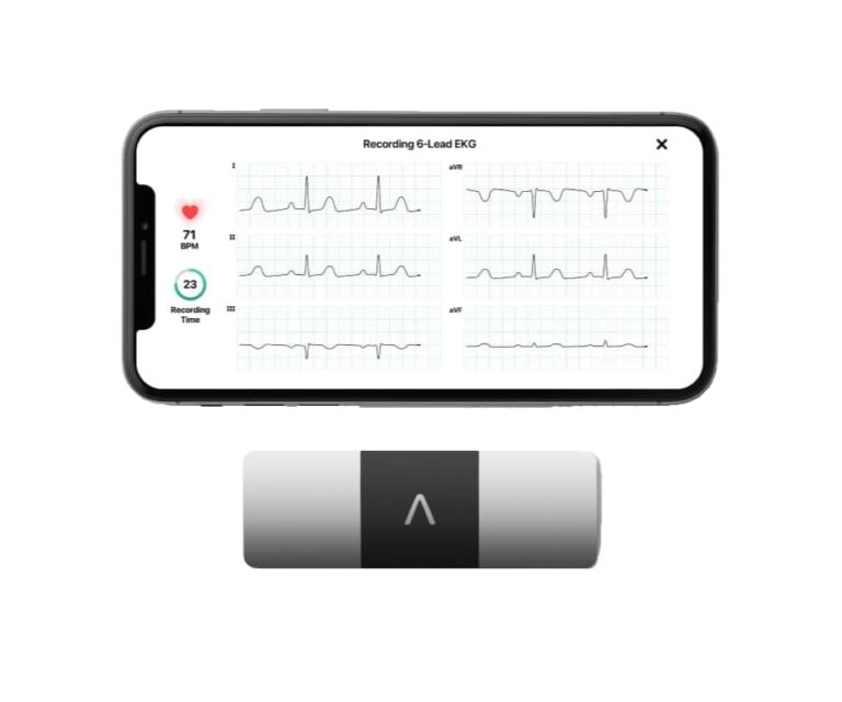 alivecor kardia6L 1