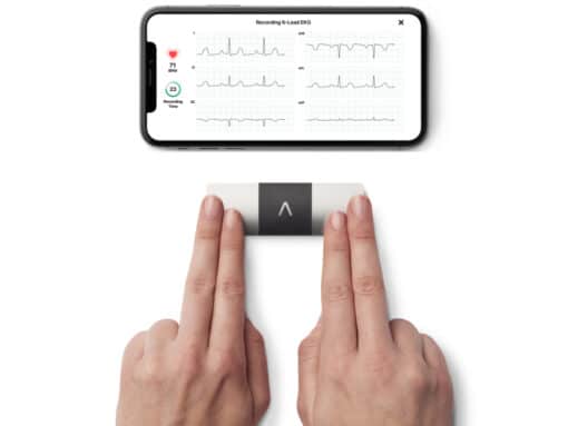 AliveCor KardiaMobile 6-kanaals ECG-apparaat – Snel een Hartfilmpje maken – Detecteert Atriumfibrilleren