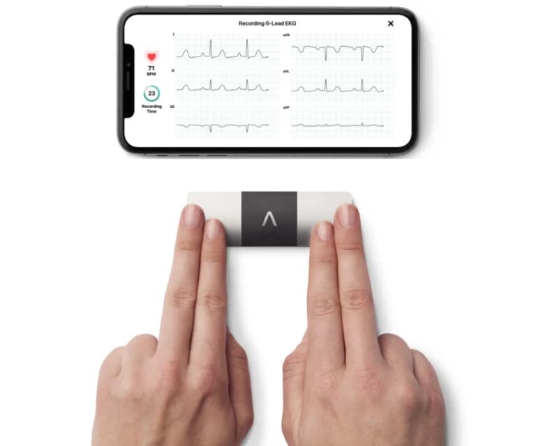 AliveCor KardiaMobile 6-kanaals ECG-apparaat – Snel een Hartfilmpje maken – Detecteert Atriumfibrilleren