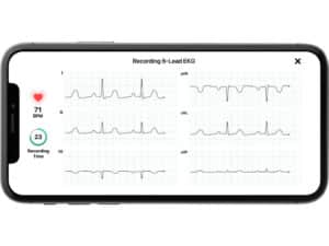alivecor kardia6l new 3