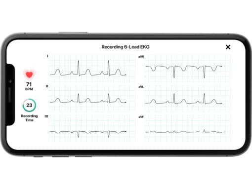 AliveCor KardiaMobile 6-kanaals ECG-apparaat – Snel een Hartfilmpje maken – Detecteert Atriumfibrilleren - Afbeelding 3