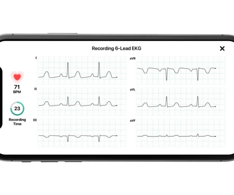 alivecor kardia6l new 3