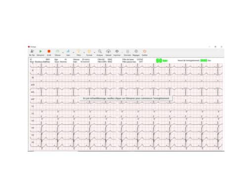 Spengler Cardiomate 12-kanaals PC ECG - Afbeelding 5