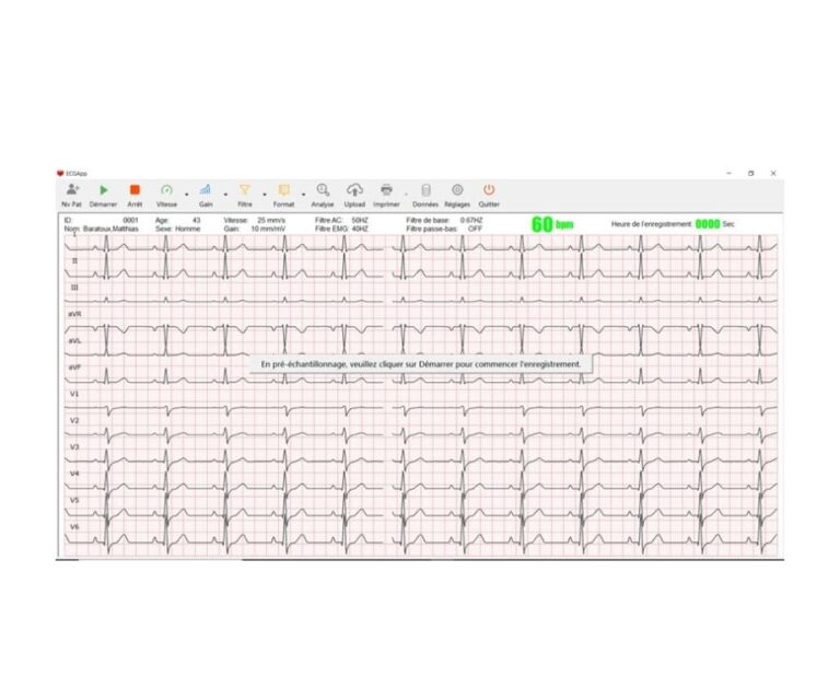 spengler cardiomate 5