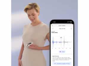 withings beamo 8