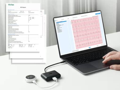Wellue 12-kanaals Lepod Pro Holtermonitor – Draagbare ECG-recorder tot 24 uur opname - Afbeelding 6