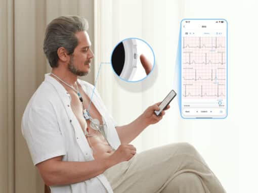 Wellue 12-kanaals Lepod Pro Holtermonitor – Draagbare ECG-recorder tot 24 uur opname - Afbeelding 7